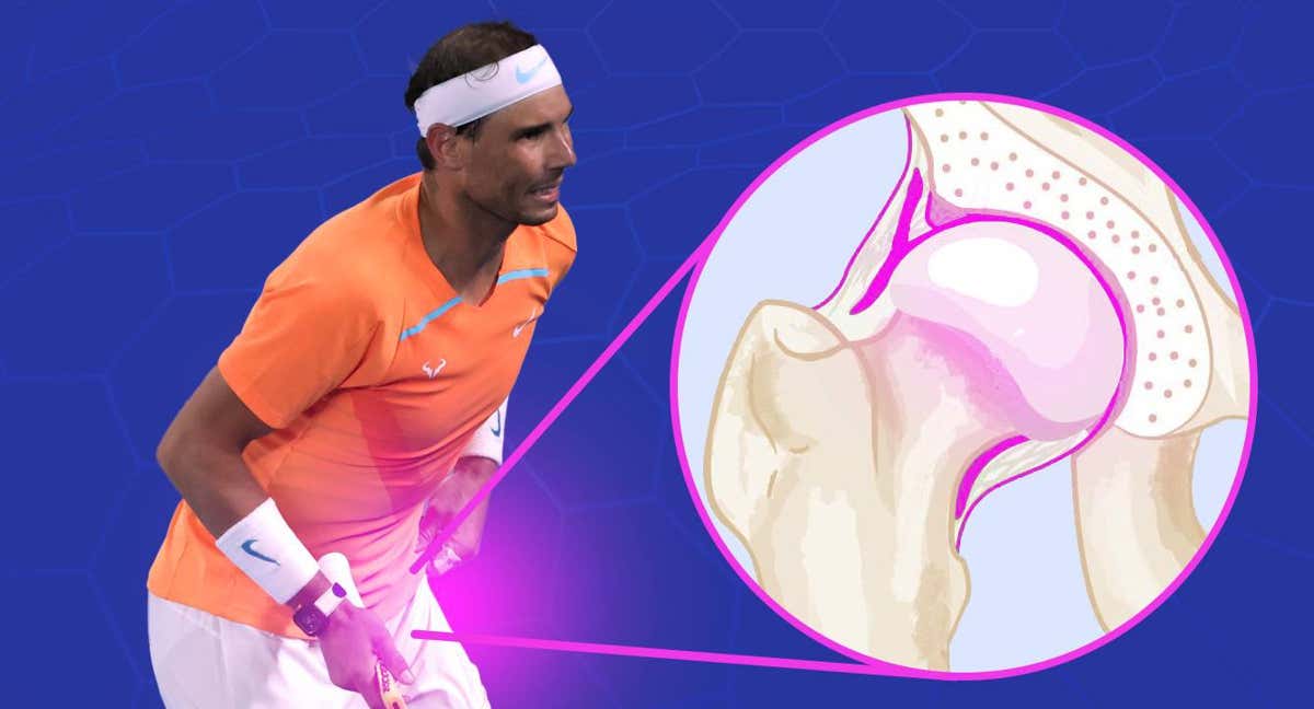 Nadal fue sometido el viernes a una operación para reparar el tejido del lábrum de su pierna izquierda. /RELEVO