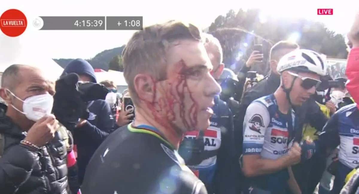 Evenepoel, con la cara ensangrentada tras ganar en Andorra./RTVE