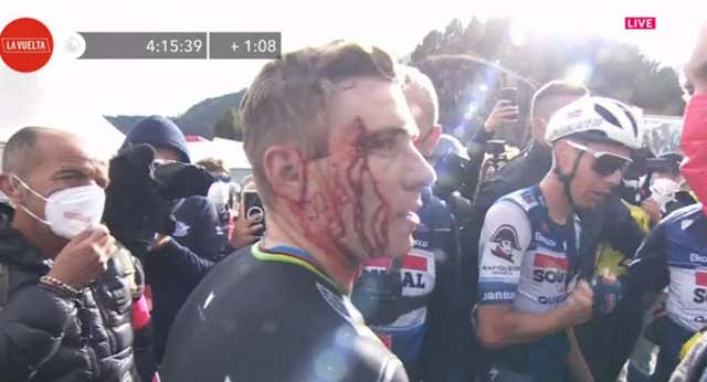 Remco Evenepoel tumba a Vingegaard… ¡y se deja media cara en la meta!