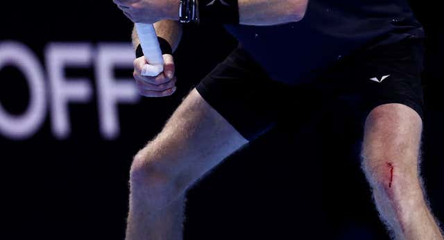 Rublev perdió los papeles con Alcaraz… ¡y acabó con la rodilla sangrando!