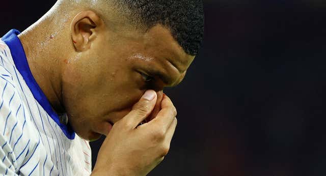 Lesión de Mbappé en la Eurocopa 2024