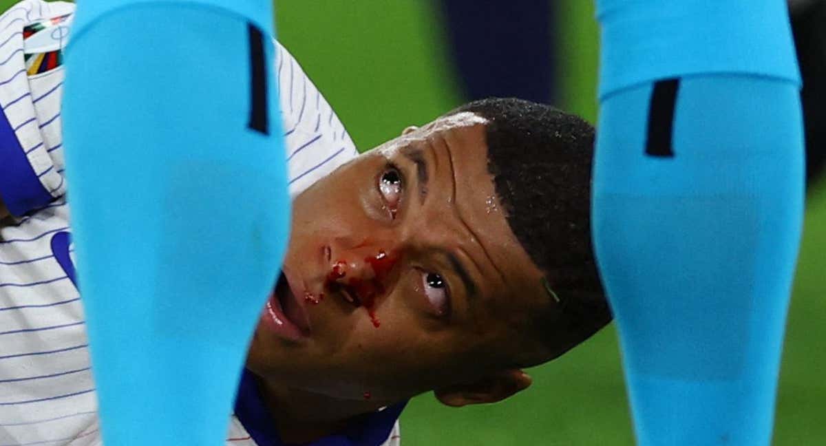 Mbappé, sangrando tras el fuerte golpe en la nariz. /REUTERS