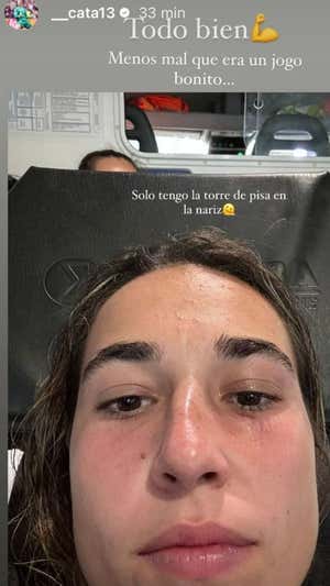 Saltan las alarmas en la Selección por la nariz de Cata Coll... y no pinta bien: «Menos mal que era un jogo bonito»