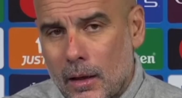 Guardiola ha acabado su partido de Champions con varios arañazos en la cara y en la cabeza.