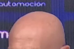 Julián Calero sufrió un pelotazo de Algobia y se quedó un poco traspuesto.