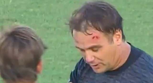 Nuevo episodio lamentable de violencia en Argentina: dejan sangrando al juez de línea tras tirarle un palo desde la grada