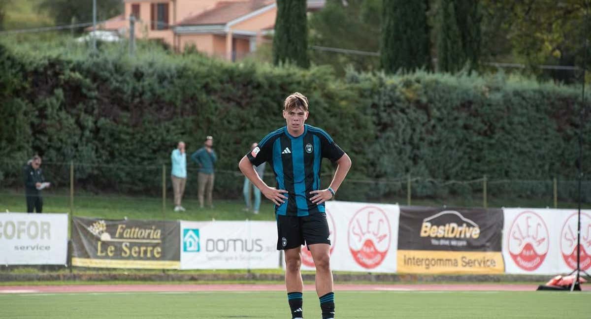 El hijo de Buffon.
