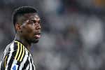 Pogba recuerda los días más duros de su depresión: “Me di cuenta cuando empecé a perder el pelo, envejecí 10 años”